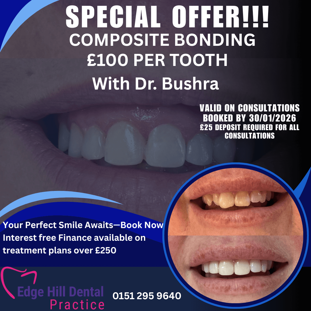 Composite Bonding Offer